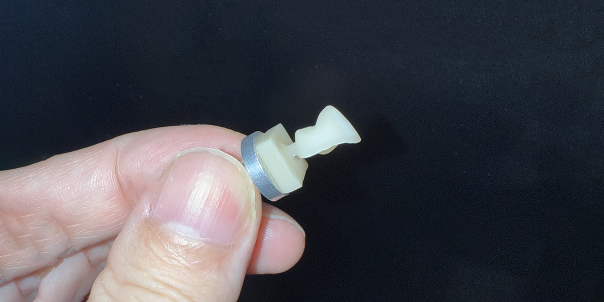 補綴物の完成